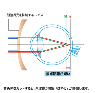 目の焦点と色収差 無色レンズの場合